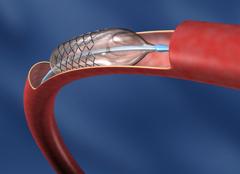 Humidification dans les services de production d'équipements médicaux